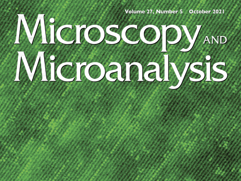 Our work is published in Microscopy and Microanalysis - the official scientific journal of the Society of Microscopy of America!